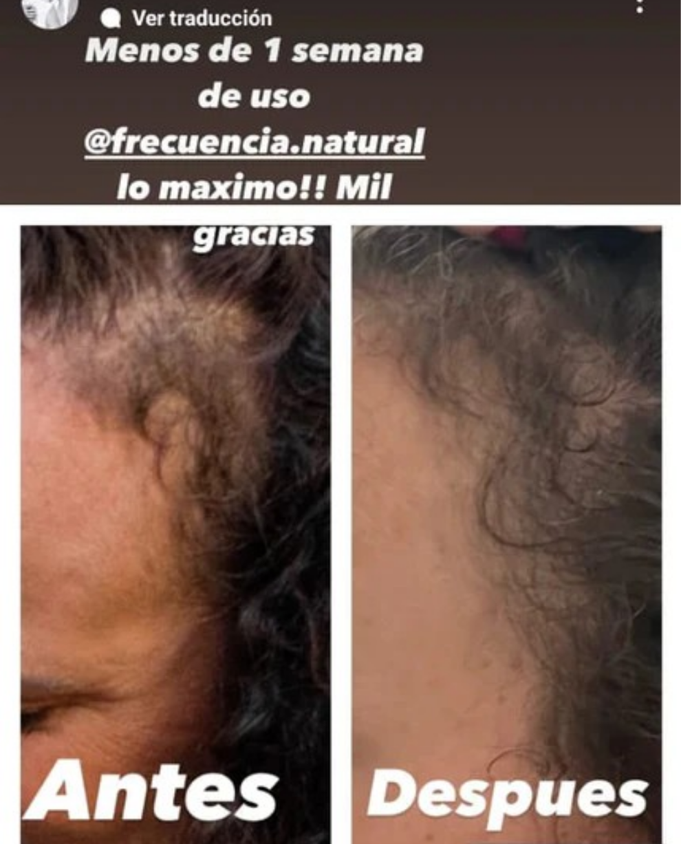 Kit Anticaida