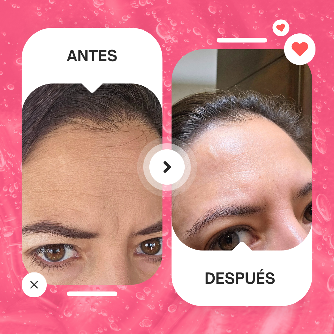 Serum Facial Antiedad con Bakuchiol