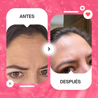 Serum Facial Antiedad con Bakuchiol